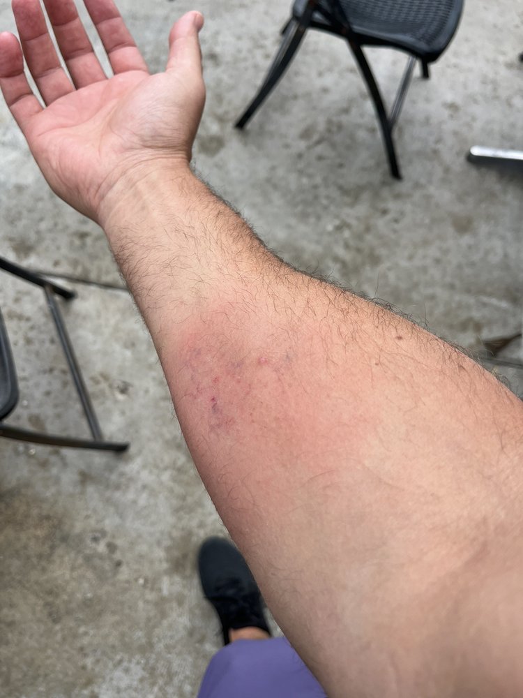 EAST BEACH BATTING CAGES Updated October 2024 11 Photos & 26