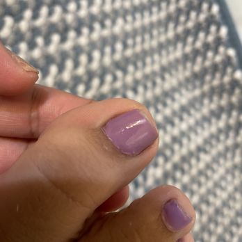 Paradise Nails - Didn't even apply the polish to the full toe nail. - Nail Salons Near Me - Santa Rosa, California Paradise Nails - Didn't even apply the polish to the full toe nail. - Nail Salons Near Me - Santa Rosa, California
