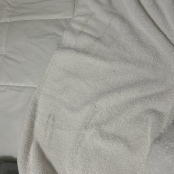 Pacific Crest Hotel Santa Barbara - Dirty stains on towels - Hotels Near Me - Santa Barbara, California Pacific Crest Hotel Santa Barbara - Dirty stains on towels - Hotels Near Me - Santa Barbara, California