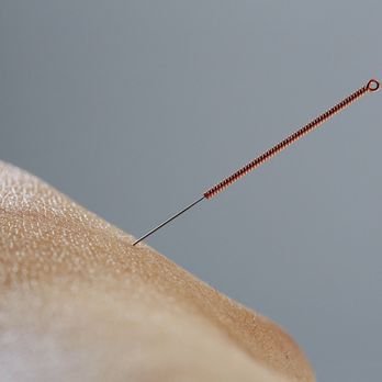 Oslo Akupunkturklinikk - Akupunktur - Acupuncture Near Me - Oslo, 03