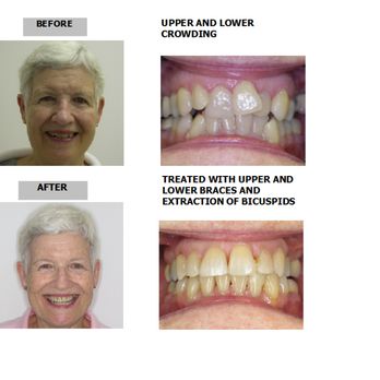 Cain Paul J, DDS - Orthodontists Near Me - Brightwaters, New York Cain Paul J, DDS - Orthodontists Near Me - Brightwaters, New York
