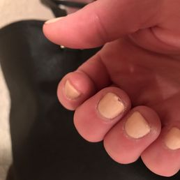 Chipped $30 gel mani after 4 days. Chipped $30 gel mani after 4 days.