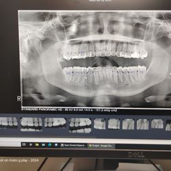 Bracco Diagnostics