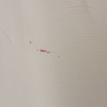 Hotel Rendale - Weird stain on sheets! - Hotels Near Me - Washington, DC, District of Columbia Hotel Rendale - Weird stain on sheets! - Hotels Near Me - Washington, DC, District of Columbia