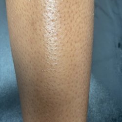 Waxed by Ashyia - Waxed leg