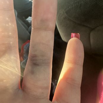 Rorinails - Proof of my nails that stayed on after my fingers broke - Jewelry Near Me - Glendale, California