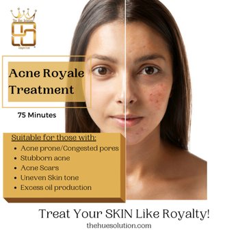 The Hue Solution - The Acne Microdermabrasion Facial - Skin Care Near Me - Durham, North Carolina