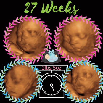 View A Miracle - 27 weeks and weighing in at 2lbs 5oz. - Ultrasound Imaging Centers Near Me - East Brunswick, New Jersey View A Miracle - 27 weeks and weighing in at 2lbs 5oz. - Ultrasound Imaging Centers Near Me - East Brunswick, New Jersey