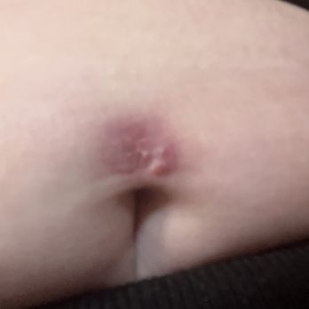 Crimson Heart Studio - My piercing rejected because it was not positioned correctly - Piercing Near Me - Federal Way, Washington Crimson Heart Studio - My piercing rejected because it was not positioned correctly - Piercing Near Me - Federal Way, Washington