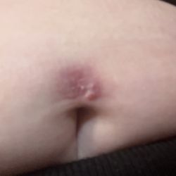 Crimson Heart Studio - My piercing rejected because it was not positioned correctly