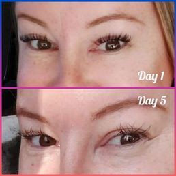 This is comparing dayb1 and day 5. This is comparing dayb1 and day 5.