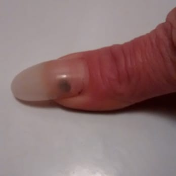 Bee's Nails - Fungus under my thumb nail that was not there prior to having a fill and gel coat that peeled off two days after being applied. - Nail Salons Near Me - Sacramento, California Bee's Nails - Fungus under my thumb nail that was not there prior to having a fill and gel coat that peeled off two days after being applied. - Nail Salons Near Me - Sacramento, California