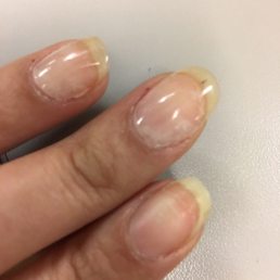 Dip polish peeled off and even got knocked off the index finger entirely, this pic was 3 days after service