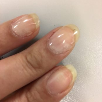 Angell Nails - Dip polish peeled off and even got knocked off the index finger entirely, this pic was 3 days after service - Nail Salons Near Me - Providence, Rhode Island