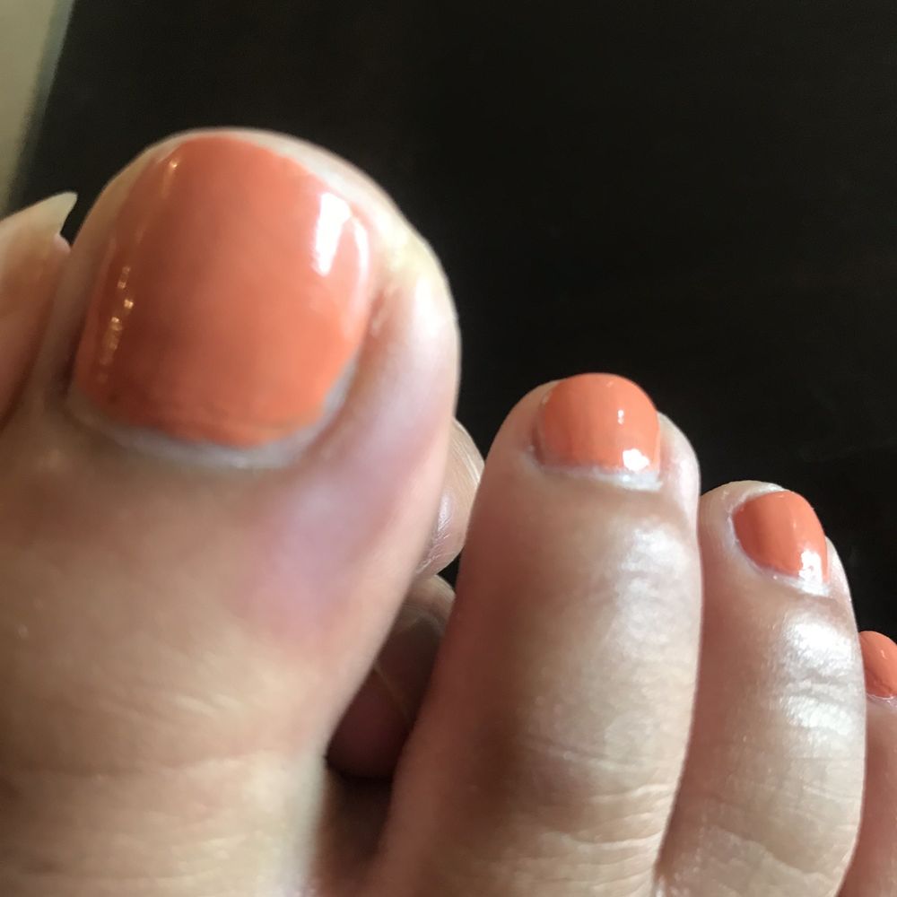 Wonder Nails & Spa - Bruised and swollen. - Nail Salons Near Me - Las Vegas, Nevada Wonder Nails & Spa - Bruised and swollen. - Nail Salons Near Me - Las Vegas, Nevada