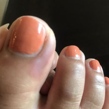 Wonder Nails & Spa - Bruised and swollen. - Nail Salons Near Me - Las Vegas, Nevada