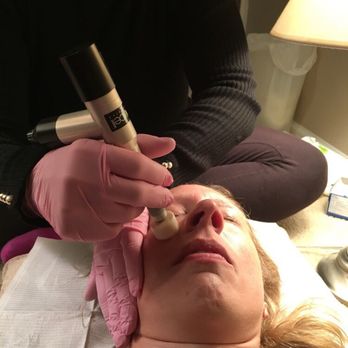 Lory’s Beauty - Procell Therapies using Microchannling - Hair Stylists Near Me - Denver, Colorado Lory’s Beauty - Procell Therapies using Microchannling - Hair Stylists Near Me - Denver, Colorado