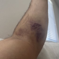 Labcorp at Walgreens - The result of routine lab work. Only 1 poke