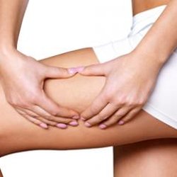 Body Shapers of Houston - Cellulite Reduction