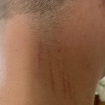 Buffalo Trim - Haircut with marks left by hairdresser - Hair Salons Near Me - East Amherst, New York