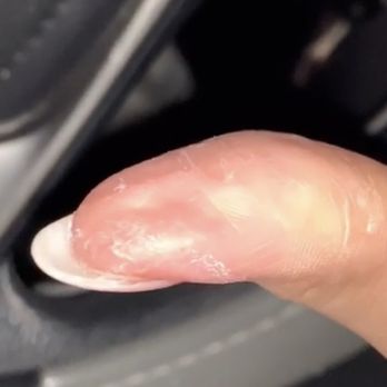 Allure Nails & Spa - The glue they left on my friends hand - Eyelash Service Near Me - Lemon Grove, California Allure Nails & Spa - The glue they left on my friends hand - Eyelash Service Near Me - Lemon Grove, California