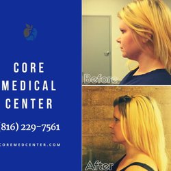 Core Medical Center - Kybella