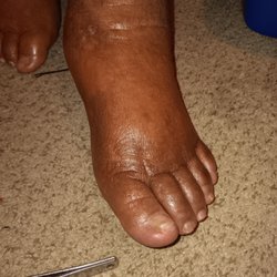 Hamilton Continuing Care Center - Healthy Foot 1