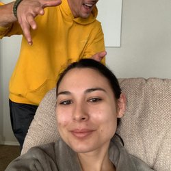 Monarch Dental & Orthodontics - Just a little swollen but clearly not in a lot of pain. My goofy caregiver in the background says this Monarch got an A+!
