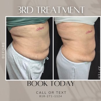 Contour Beauty Lab - Body Contouring Near Me Contour Beauty Lab - Body Contouring Near Me