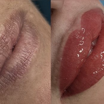 Glow Aesthetics - Offering Permanent make up services such as lip blush
Edite and after - Estheticians Near Me - Temecula, California Glow Aesthetics - Offering Permanent make up services such as lip blush
Edite and after - Estheticians Near Me - Temecula, California