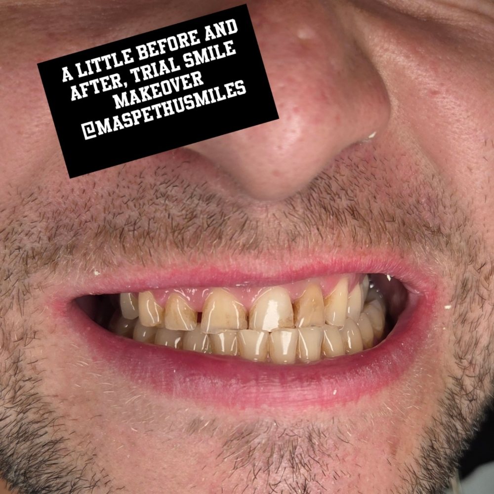 Maspeth USmiles Dental Care