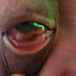 Fillmore Eye Clinic