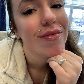 Ageless Aesthetics MD Medspa - Right after first lip filler. - Medical Spas Near Me - Fredericksburg, Virginia Ageless Aesthetics MD Medspa - Right after first lip filler. - Medical Spas Near Me - Fredericksburg, Virginia