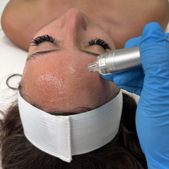 Pearl Skin - Skin Care Near Me - Hermosa Beach, California Pearl Skin - Skin Care Near Me - Hermosa Beach, California