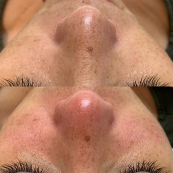 By Nikolle - Deep Pore Cleansing Facial - Eyebrow Services Near Me - Honolulu, Hawaii By Nikolle - Deep Pore Cleansing Facial - Eyebrow Services Near Me - Honolulu, Hawaii