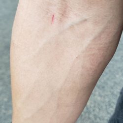 Labcorp - Lab tech botched blood draw. didn't hurt but for those who are needle phobic beware