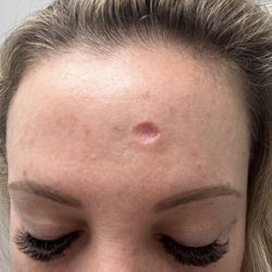 Leslie Storey, MD - Valley Skin Institute