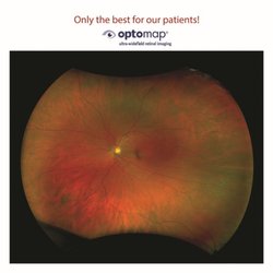 Eric M. Selander, OD - Optomap
