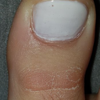 Modern Nails Studio - Blotchy and not painted all the way - Nail Salons Near Me - Laguna Beach, California Modern Nails Studio - Blotchy and not painted all the way - Nail Salons Near Me - Laguna Beach, California