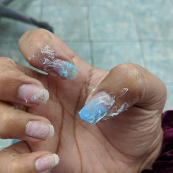 C F Nail Care - Look how they left me, after they ripped off my pinky, ring, and middle finger tips off. - Nail Salons Near Me - Englewood, New Jersey C F Nail Care - Look how they left me, after they ripped off my pinky, ring, and middle finger tips off. - Nail Salons Near Me - Englewood, New Jersey
