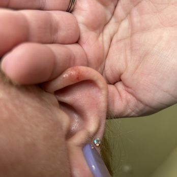 Hair Cuttery - What I believe to be a chemical burn on my ear - Hair Stylists Near Me - Palm Bay, Florida