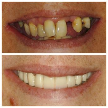DICE Dental - Springfield - Cosmetic Dentists Near Me - Springfield, Pennsylvania