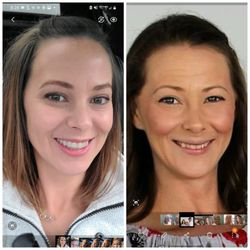 Gina Randhawa, MD - Now at 40 vs. pretreatment at 36.