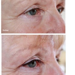 Pariti Cosmetic - Augen Permanent make-up