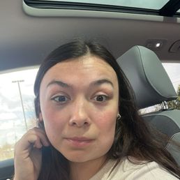 Day 2 swelling Day 2 swelling