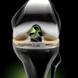 Orthopaedic Specialties