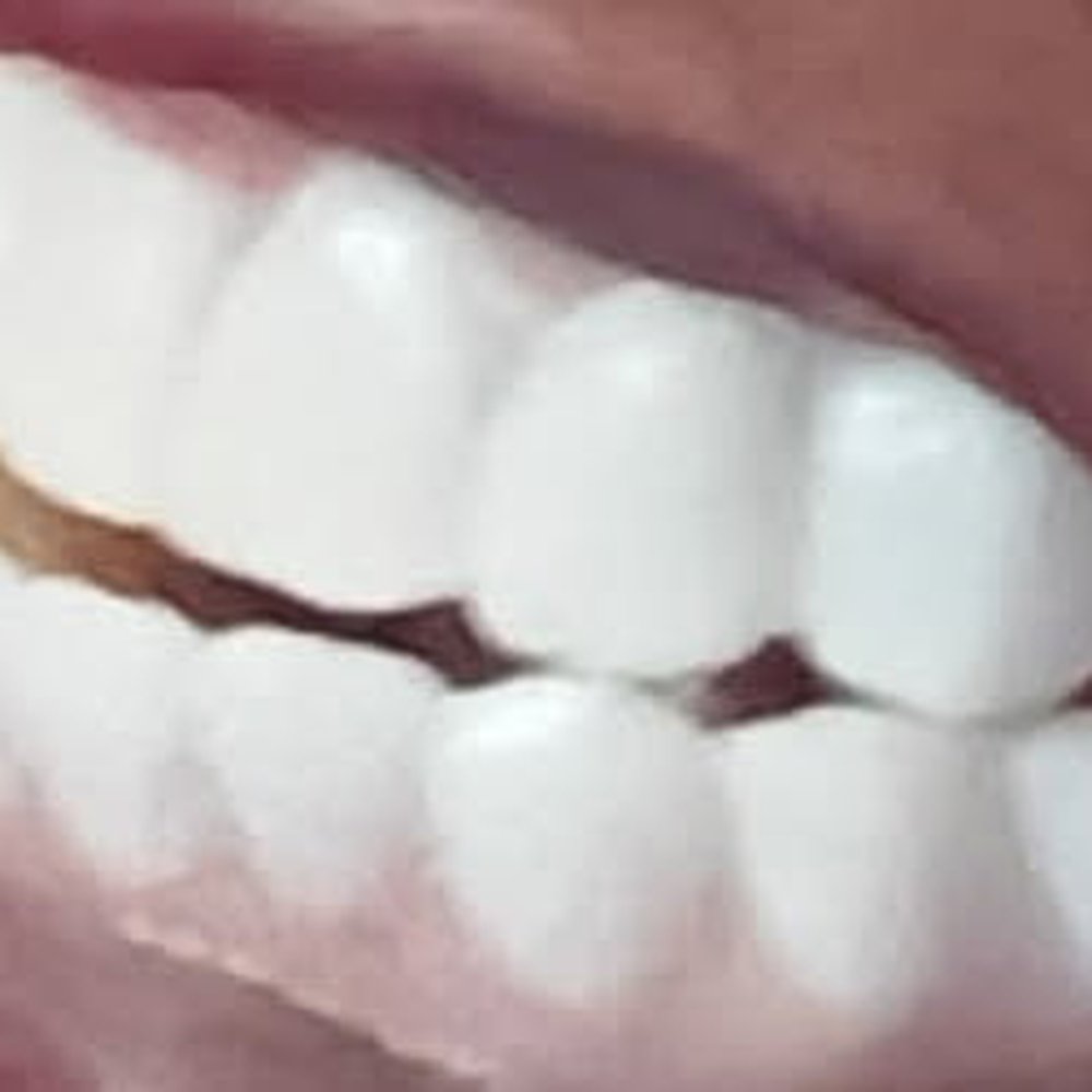 Flossy Dental Group - Dr. Lin Thu decided to give me an underbite ive never had in my entire life. Such an unprofessional job. He never listened to my requests... - General Dentistry Near Me - Harbor City, California Flossy Dental Group - Dr. Lin Thu decided to give me an underbite ive never had in my entire life. Such an unprofessional job. He never listened to my requests... - General Dentistry Near Me - Harbor City, California