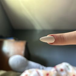 Robinson Nail Spa - The irritation around my nail bed, the left side was blistered