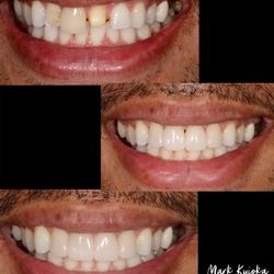 Mark Kuioka, DDS