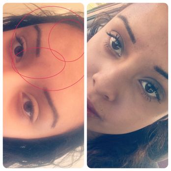 Olive Tree Aesthetic Studio  - My Botox from bumpy forehead to smooth forehead!! - Medical Spas Near Me - Castle Rock , Colorado